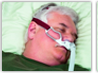 sleep apnea treatment